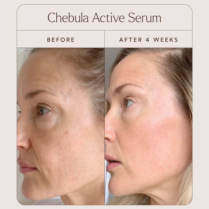 True Botanicals-A True Transformation-Skincare-TB_TrueTransformation_B_A2-The Detox Market |
