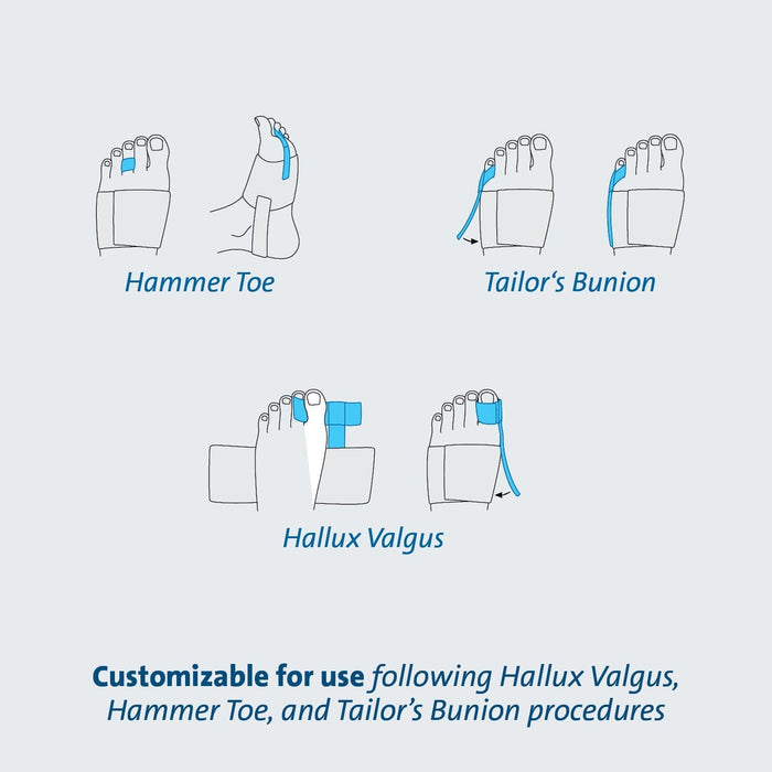 Darco Toe Alignment Splint, One Size Fits Most - TAS-Single - LL Medico