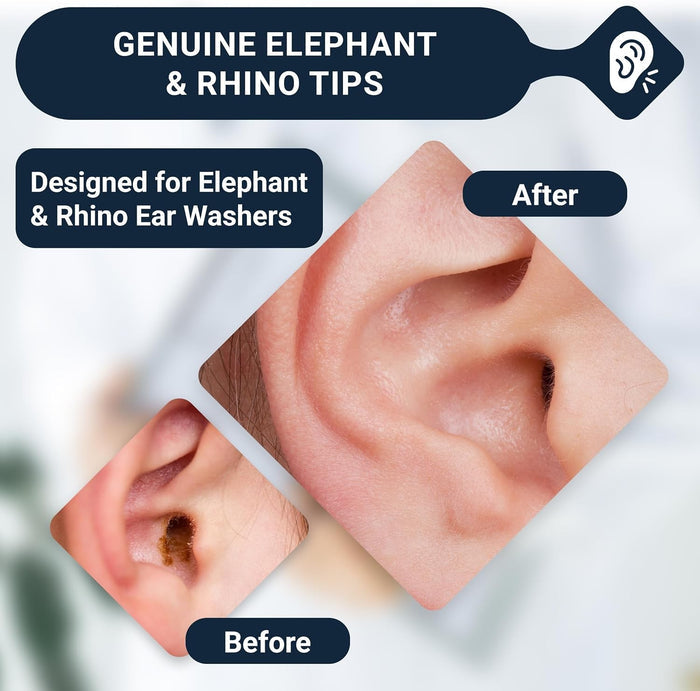 Doctor Easy Rhino/Elephant Ear Washer Single-Use Tips, Pack of 20