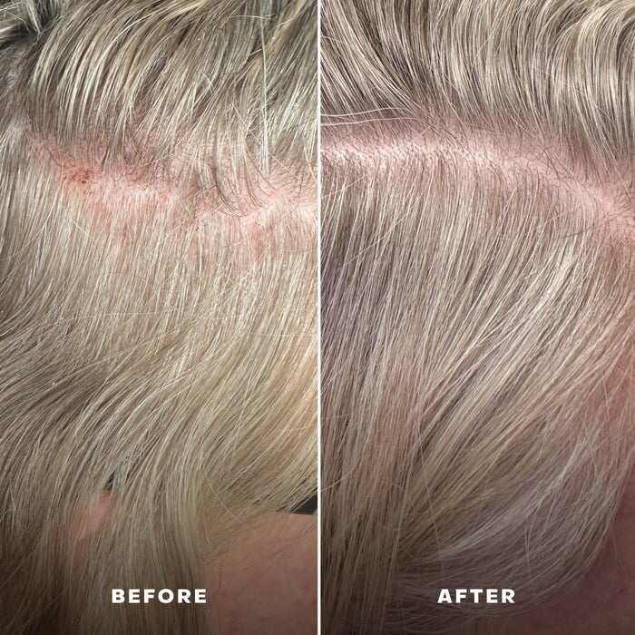 Everist-Everboost Multi-Peptide Scalp Serum-Hair-Everist_6-The Detox Market |