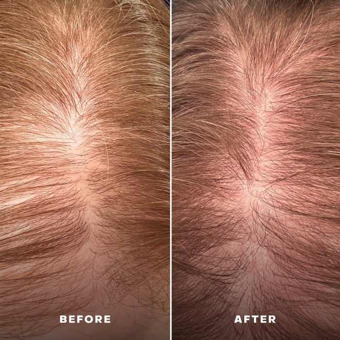 Everist-Everboost Multi-Peptide Scalp Serum-Hair-Everist_5-The Detox Market |