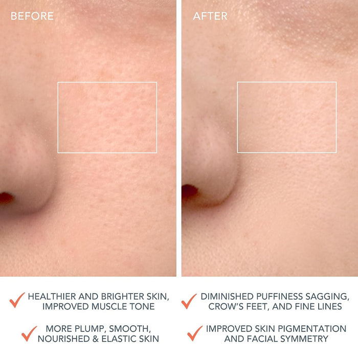LUNA 4 Facial Cleansing Device for Balanced Skin
