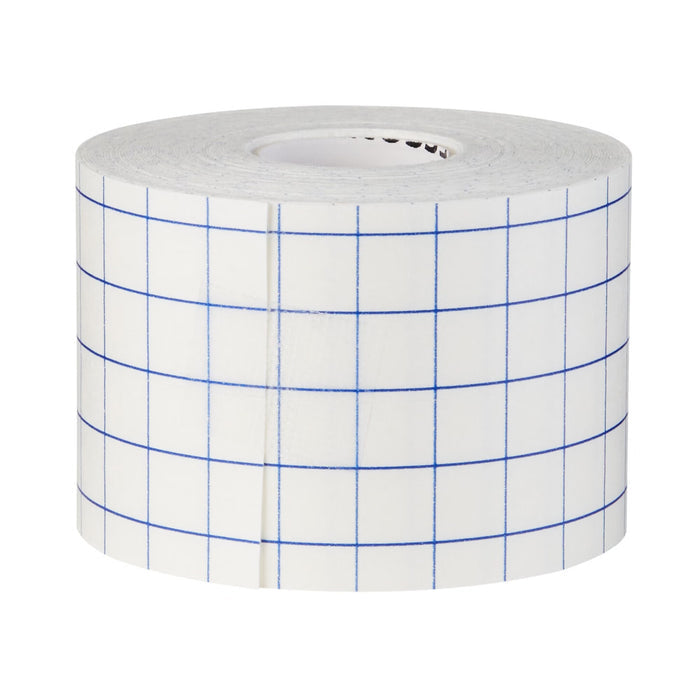 McKesson Nonwoven Fabric Dressing Retention Tape, 2 Inch x 10 Yard