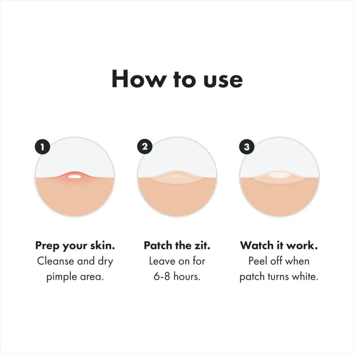 Mighty Patch Acne Treatment