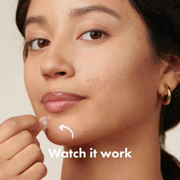 Mighty Patch Acne Treatment