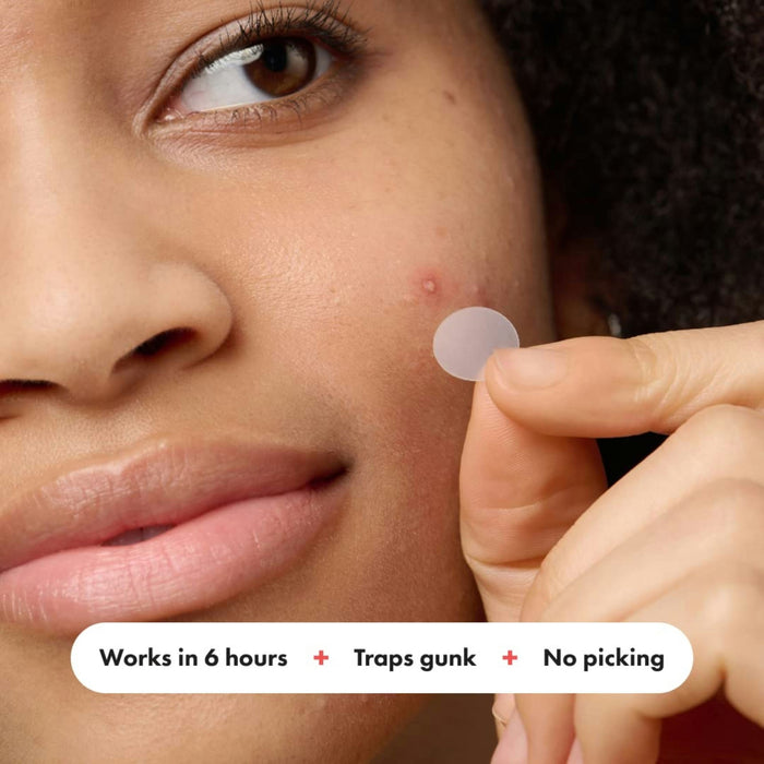 Mighty Patch Acne Treatment
