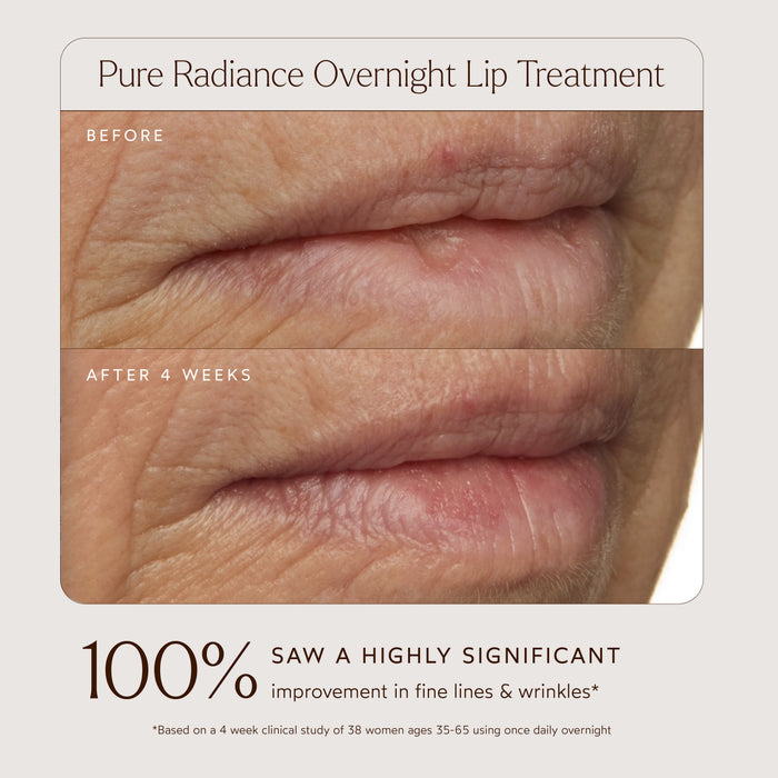 True Botanicals-Pure Radiance Overnight Lip Treatment-Skincare-S-W-D-LP01-R_3_07e00d0d-269d-46d8-90ad-ab118ce849d3-The Detox Market |