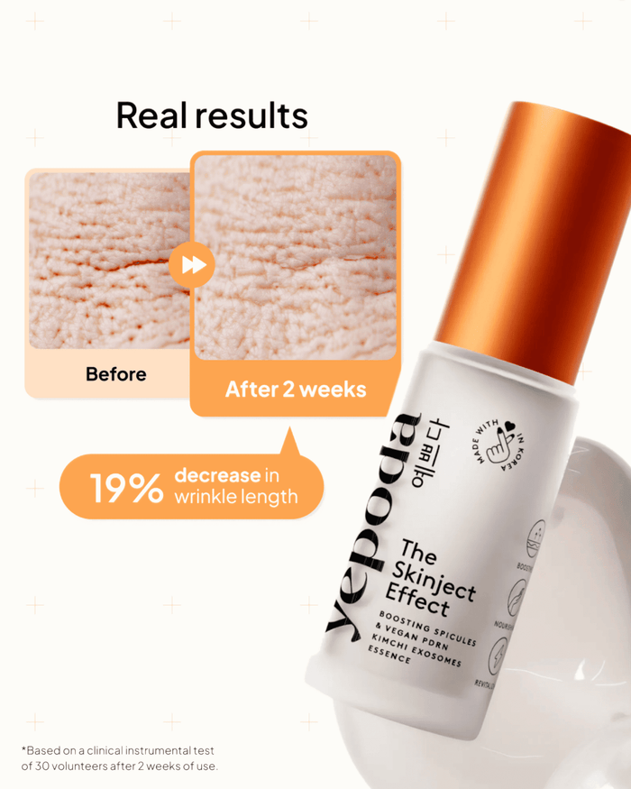 The Skinject Effect