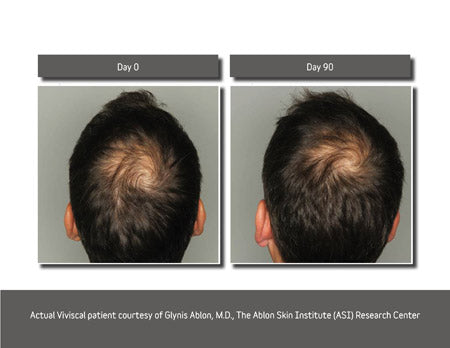 Viviscal Man Advance Hair Health Vitamins